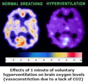 Effects of hyperventilation on sleep