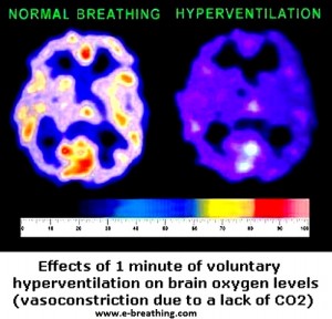 brain-oxygen-effects-hypocapnia-hyperventilation -1